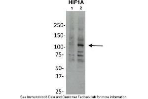 Western Blotting (WB) image for anti-Hypoxia Inducible Factor 1, alpha Subunit (Basic Helix-Loop-Helix Transcription Factor) (HIF1A) (Middle Region) antibody (ABIN2780373)