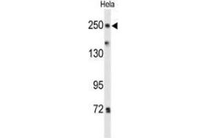 Western blot analysis of PTPRD(arrow) in Hela cell line lysates (35ug/lane) using PTPRD  Antibody  (N-term).