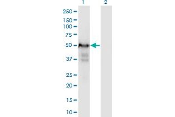 PLRG1 Antikörper  (AA 101-198)