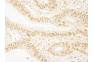 Immunohistochemistry (IHC) image for anti-Leo1, Paf1/RNA Polymerase II Complex Component, Homolog (S. Cerevisiae) (LEO1) (AA 550-600) antibody (ABIN7448630)