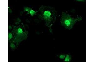 Immunofluorescence (IF) image for anti-Aryl Hydrocarbon Receptor Interacting Protein-Like 1 (AIPL1) antibody (ABIN1496509) (AIPL1 antibody)