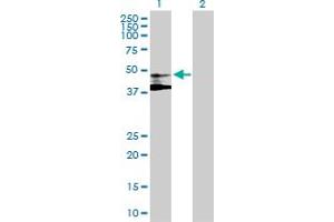 Western Blot analysis of ST3GAL3 expression in transfected 293T cell line by ST3GAL3 MaxPab polyclonal antibody. (ST3GAL3 antibody  (AA 1-390))