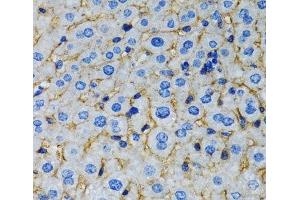 Immunohistochemistry of paraffin-embedded Rat liver using RAF1 Polyclonal Antibody at dilution of 1:100 (40x lens). (RAF1 antibody)