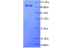 SDS-PAGE (SDS) image for Mannose Receptor, C Type 1 (MRC1) (AA 655-1213), (partial) protein (His tag) (ABIN5713666)