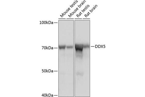 DDX5 anticorps