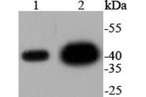 Lane 1: HeLa Cell lysates, Lane 2: PC-12 Cell lysates, Lane 3: CRC lysates, probed with ERK2 (3G1) Monoclonal Antibody  at 1:1000 overnight at 4˚C. (ERK2 antibody)