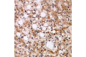 Immunohistochemical analysis of SPFH1 staining in human liver formalin fixed paraffin embedded tissue section. (ERLIN1 antibody)