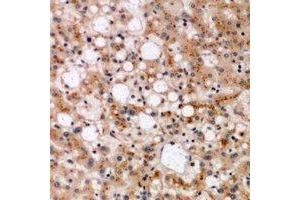 Immunohistochemical analysis of SPFH1 staining in human liver formalin fixed paraffin embedded tissue section. (ERLIN1 antibody)