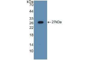 Detection of Recombinant ASGR1, Mouse using Polyclonal Antibody to Asialoglycoprotein Receptor 1 (ASGR1) (Asialoglycoprotein Receptor 1 antibody  (AA 80-281))