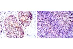Immunohistochemistry (IHC) image for anti-Eukaryotic Translation Elongation Factor 2 (EEF2) antibody (ABIN969090)