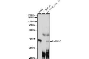 Immunoprecipitation analysis of 300 μg extracts of K-562 cells using 3 μg hnRNP C antibody (ABIN7267630). (HNRNPC antibody)