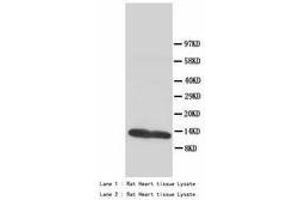 Image no. 2 for anti-Fatty Acid Binding Protein 3, Muscle and Heart (FABP3) (AA 119-133) antibody (ABIN1493379) (FABP3 antibody  (AA 119-133))
