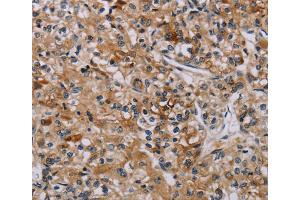 Immunohistochemistry (IHC) image for anti-Apoptosis-Associated tyrosine Kinase (AATK) antibody (ABIN2827106) (AATK antibody)