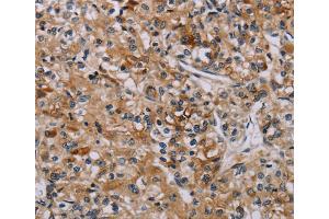 Immunohistochemistry (IHC) image for anti-Apoptosis-Associated tyrosine Kinase (AATK) antibody (ABIN5546867) (AATK antibody)