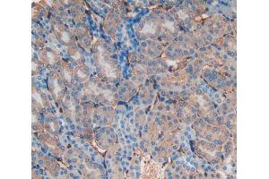 Immunohistochemistry (IHC) image for anti-Intercellular Adhesion Molecule 1 (ICAM1) (AA 46-301) antibody (ABIN1077699)