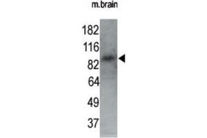 Western Blotting (WB) image for anti-MAP/microtubule Affinity-Regulating Kinase 1 (MARK1) antibody (ABIN2995250) (MARK1 antibody)