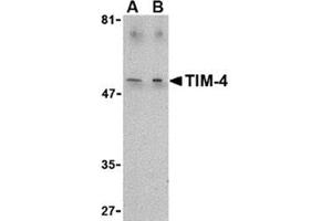 Image no. 1 for anti-T-Cell Immunoglobulin and Mucin Domain Containing 4 (TIMD4) (C-Term) antibody (ABIN318767) (TIMD4 antibody  (C-Term))