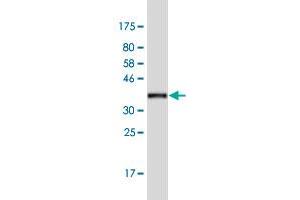 Western Blot detection against Immunogen (37. (LRGUK antibody  (AA 721-825))