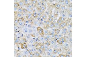 Immunohistochemistry of paraffin-embedded rat liver using APOC1 antibody at dilution of 1:100 (40x lens).