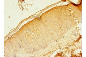 Immunohistochemistry of paraffin-embedded human skin tissue using ABIN7167306 at dilution of 1:100 (RAB37 antibody  (AA 2-220))