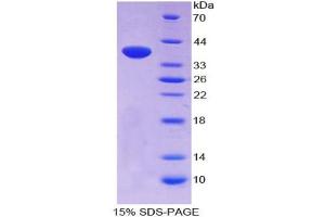 Image no. 1 for Neuropeptide S (NPS) (AA 31-85) protein (His tag,GST tag) (ABIN6236690) (NPS Protein (AA 31-85) (His tag,GST tag))