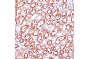 Immunohistochemistry (IHC) image for anti-serine Hydroxymethyltransferase 1 (Soluble) (SHMT1) (AA 285-444) antibody (ABIN6147744)
