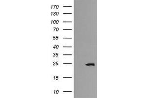 Image no. 1 for anti-RAB21, Member RAS Oncogene Family (RAB21) antibody (ABIN1500548) (RAB21 antibody)