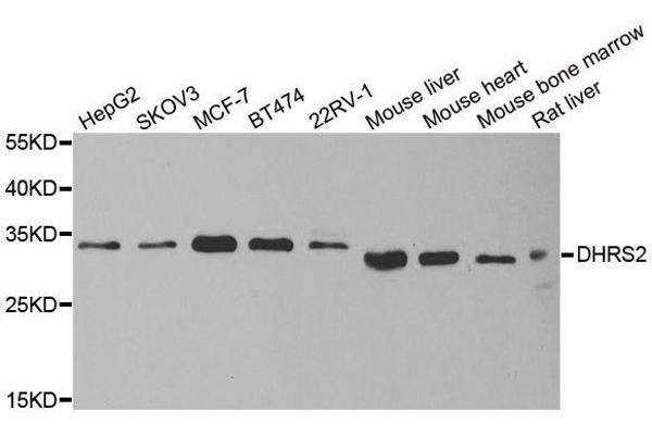 DHRS2 antibody  (AA 1-300)