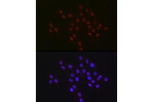 Immunofluorescence analysis of PC-12 cells using USP39 Rabbit mAb (ABIN7271160) at dilution of 1:100 (40x lens). (USP39 antibody)