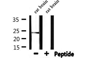 Western blot analysis of extracts from rat brain, using HSPB2 Antibody. (HSPB2 antibody  (Internal Region))