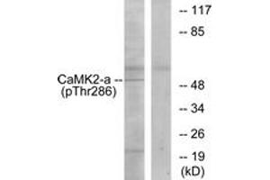 Western blot analysis of extracts from K562 cells, using CaMK2 (Phospho-Thr286) Antibody. (CAMK2B antibody  (pThr286))