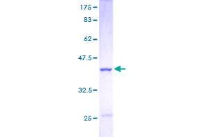 CSTB Protein (AA 1-98) (GST tag)