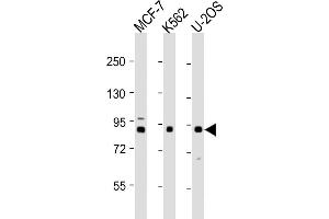 All lanes : Anti-PLOD1 Antibody (N-term) at 1:1000-1:2000 dilution Lane 1: MCF-7 whole cell lysates Lane 2: K562 whole cell lysates Lane 3: U-2OS whole cell lysates Lysates/proteins at 20 μg per lane.