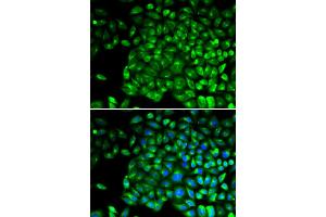 Immunofluorescence analysis of U2OS cells using TNFRSF1B antibody (ABIN5970147).