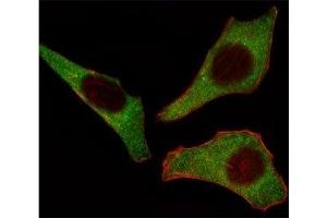 Fluorescent image of HeLa cells stained with CDK4 antibody at 1:25. (CDK4 antibody  (AA 273-305))