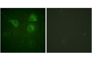 Immunofluorescence (IF) image for anti-Cell Division Cycle 25 Homolog B (S. Pombe) (CDC25B) (AA 289-338) antibody (ABIN2888593) (CDC25B antibody  (AA 289-338))