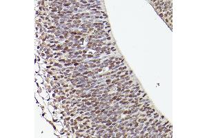 Immunohistochemistry of paraffin-embedded mouse fetal Brain using TET1 Rabbit pAb (ABIN3022030, ABIN3022031, ABIN3022032, ABIN1513597 and ABIN6218576) at dilution of 1:50 (40x lens). (TET1 antibody)