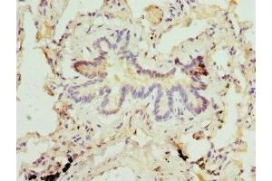 Immunohistochemistry of paraffin-embedded human lung tissue using ABIN7159380 at dilution of 1:100 (MBTPS1 antibody  (AA 803-1052))