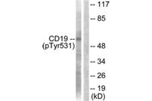 Western blot analysis of extracts from COS7 cells treated with Serum 10% 30', using CD19 (Phospho-Tyr531) Antibody. (CD19 antibody  (pTyr531))