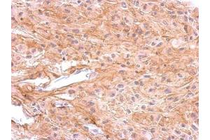 IHC-P Image Immunohistochemical analysis of paraffin-embedded U373 xenograft, using Dopamine Receptor D1, antibody at 1:500 dilution. (Dopamine Receptor d1 antibody  (C-Term))