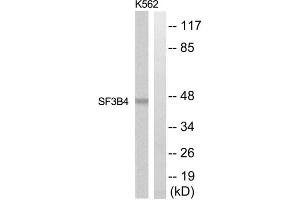 Western blot analysis of extracts from K562 and Jurkat cells, using SF3B4 antibody. (SF3B4 antibody  (Internal Region))