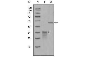 Western Blot showing Mammaglobin-1 antibody used against full-length GST- Mammaglobin-1 (1) and full-length MBP- Mammaglobin-1 (aa1-193) recombinant protein (2). (Mammaglobin A antibody  (AA 1-193))