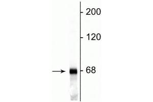 Western blot of rat cortical lysate showing specific immunolabeling of the ~68 kDa NF-L protein. (NEFL antibody)