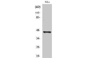 Western Blotting (WB) image for anti-Plasma Kallikrein HC (Arg390), (cleaved) antibody (ABIN3181850) (Plasma Kallikrein HC (Arg390), (cleaved) antibody)