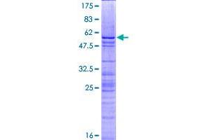 Image no. 1 for H1 Histone Family, Member 0 (H1F0) (AA 1-194) protein (GST tag) (ABIN1306277) (Histone H1 Protein (AA 1-194) (GST tag))