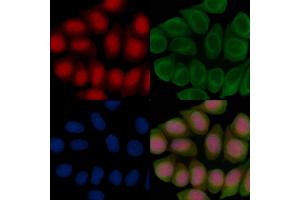 ABIN7096729 and ABIN7100794 staining Hela cells(45 min of heat-shock treatment) by IF/ICC.