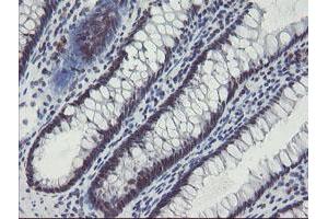 Image no. 1 for anti-SUMO1/sentrin/SMT3 Specific Peptidase 2 (SENP2) (AA 139-523) antibody (ABIN1490931) (SENP2 antibody  (AA 139-523))