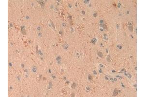 Detection of C1qA in Human Brain Tissue using Polyclonal Antibody to Complement Component 1, Q Subcomponent A (C1qA) (C1QA antibody  (AA 28-245))