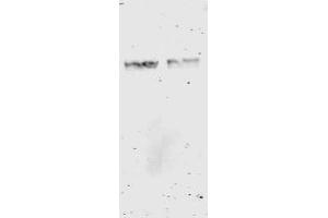 Western Blotting (WB) image for anti-Glutathione S Transferase (GST) antibody (ABIN400782) (GST antibody)