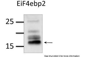 Sample Type: mouse brain extract (50ug)Primary Dilution: 1:1000Image Submitted by: Veronique DorvalLaval University, Canada . (eIF4EBP2 antibody  (N-Term))